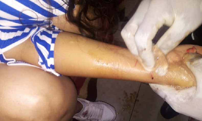 Intento de suicidio