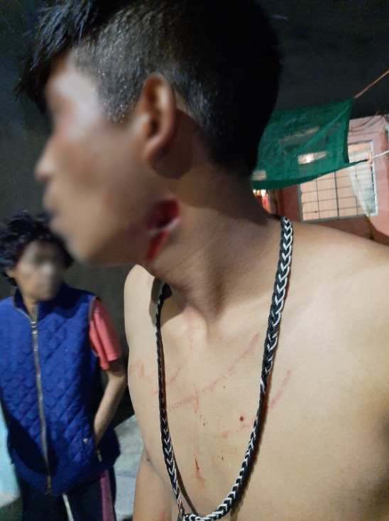 Adolescentes lesionados durante riña en Villas del Río