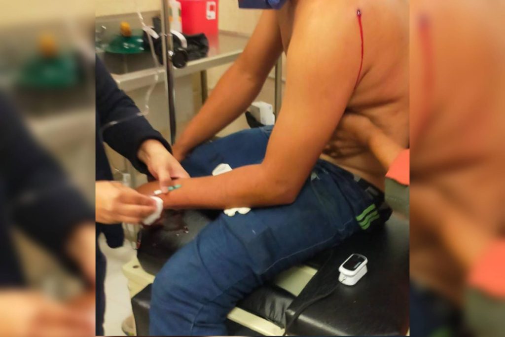 hombre baleado riña Asientos