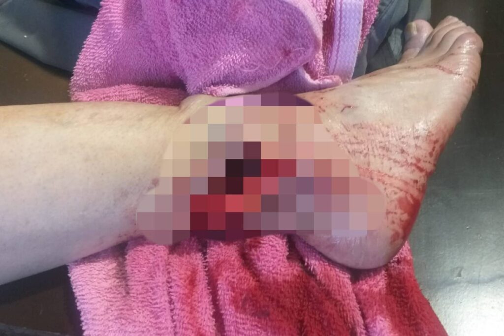 pistoleros balearon sujeto