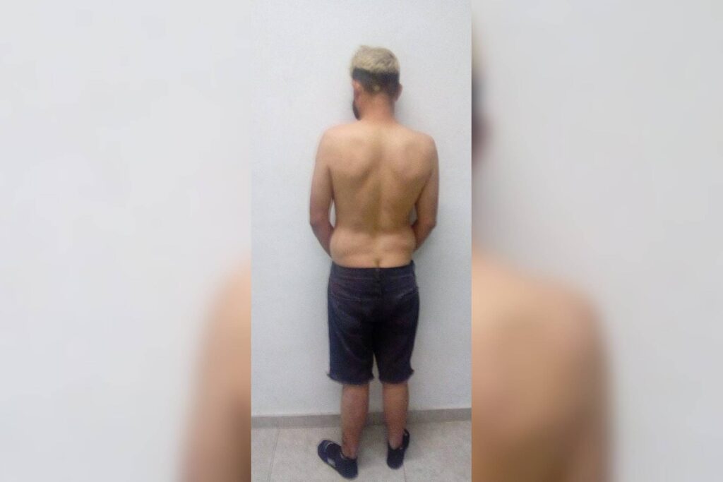 óscar reventó nariz esposa