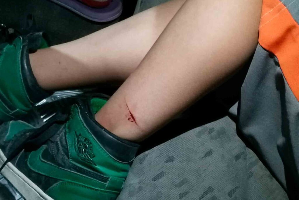 Aguascalientes Machete Ataque Menor de Edad