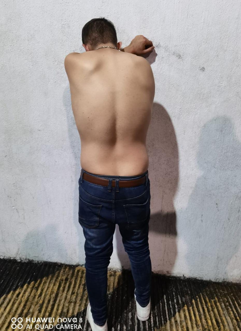 GOLPEO A UN HOMBRE Y LO DEJA INCONSCIENTE