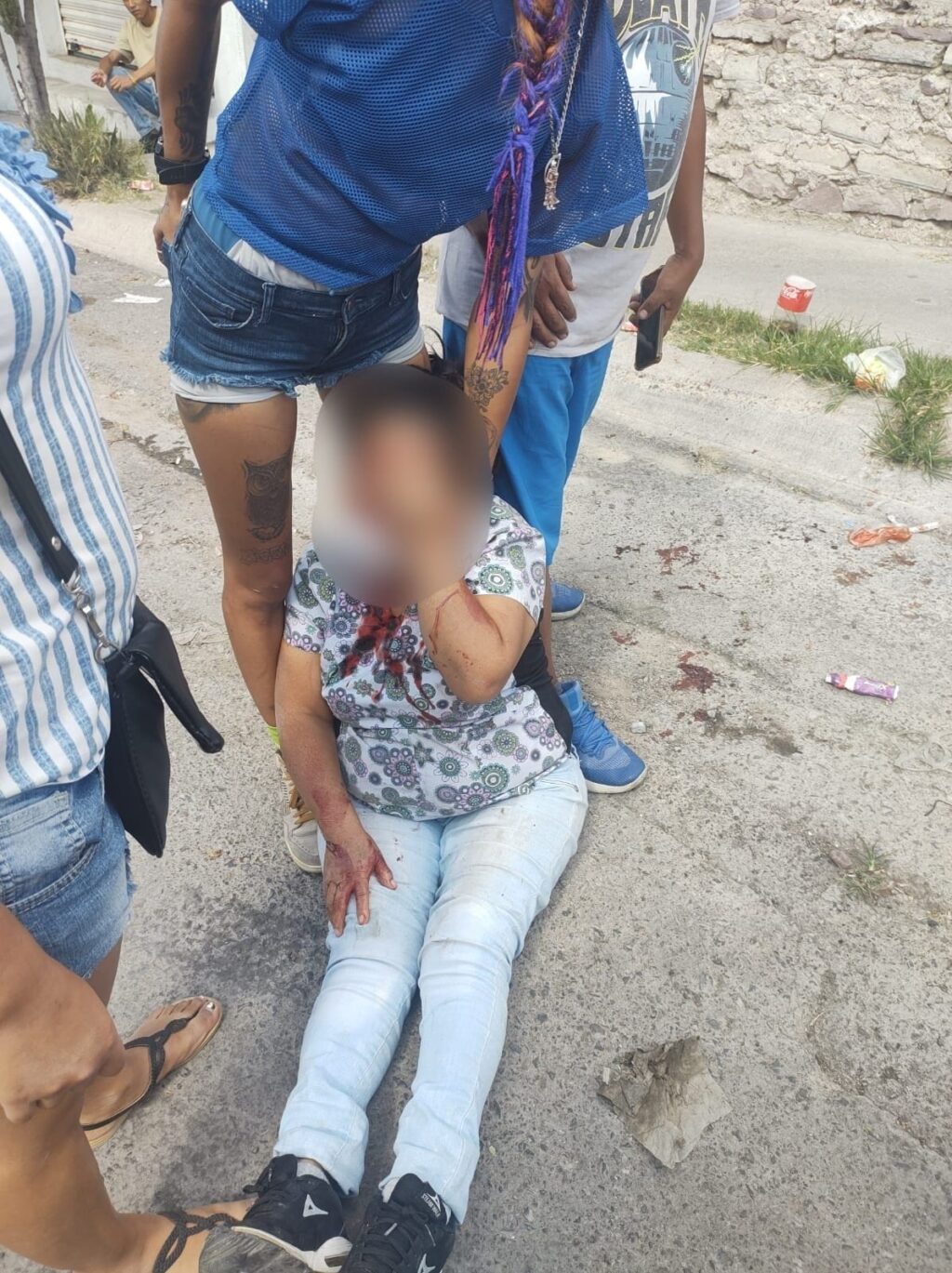 MUJER ES ATACADA  POR PERROS PUTBULL