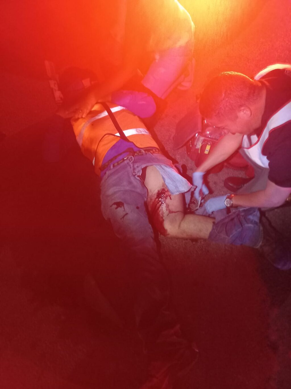 RESULTA GRAVE UN MOTOCICLISTA TRAS SER IMPACTADO POR UN CAMION