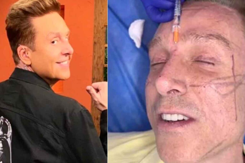 Daniel Bisogno rejuvenecimiento facial