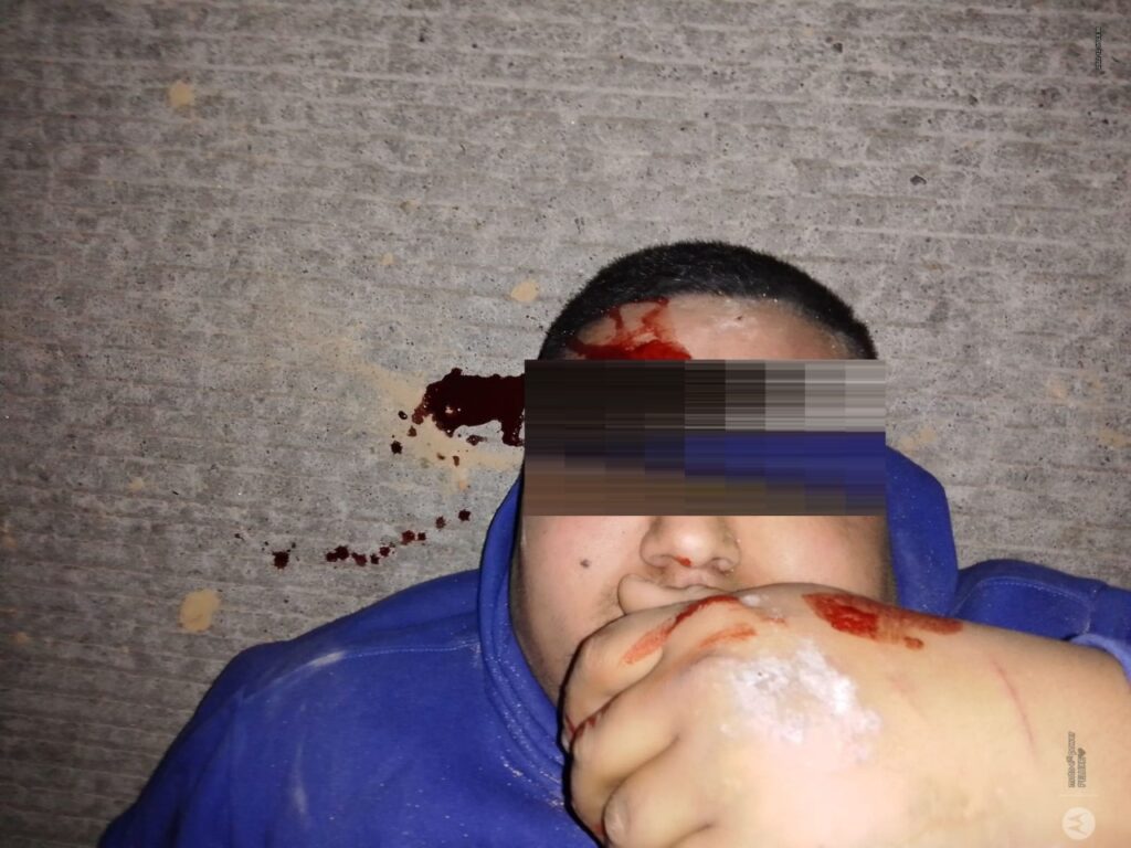 LO ACUCHILLARON POR ANDAR PARTICIPANDO EN UNA RIÑA