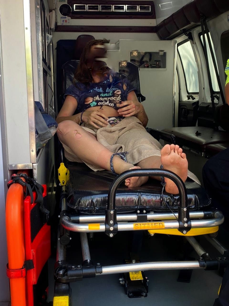 CUATRO PERSONAS RESULTARON  HERIDAS TRAS UN FLAMAZO DE GAS, DOS SE REPORTAN MUY GRAVES DE SALUD