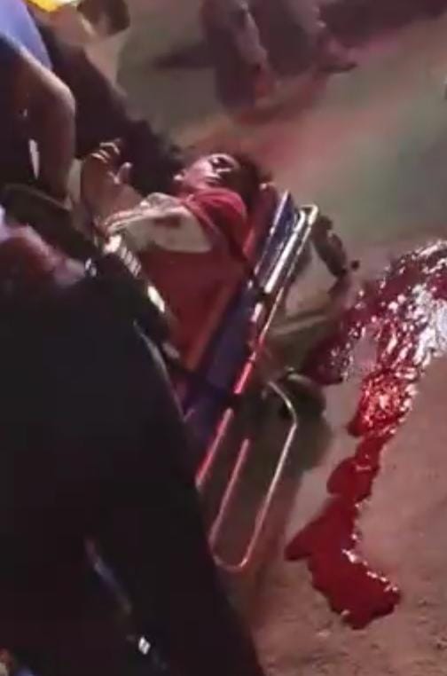 POLICIA BALEA A UN ADOLESCENTE QUE PARTICIPO EN UNA RIÑA AL ORIENTE DE LA CIUDAD