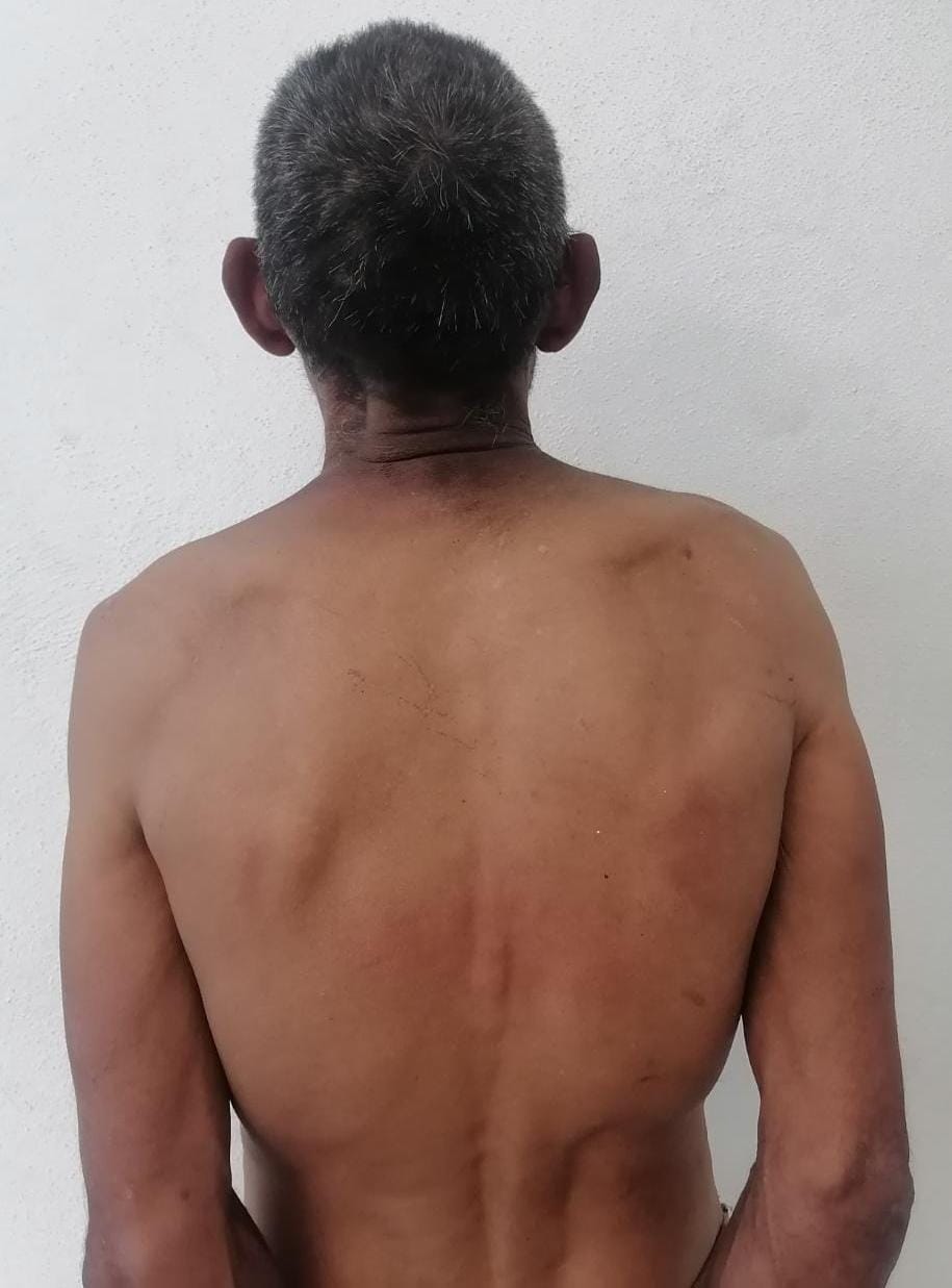 DESGRACIADO LE TUMBA LOS DIENTES A SU MAMA, YA ESTA DETENIDO