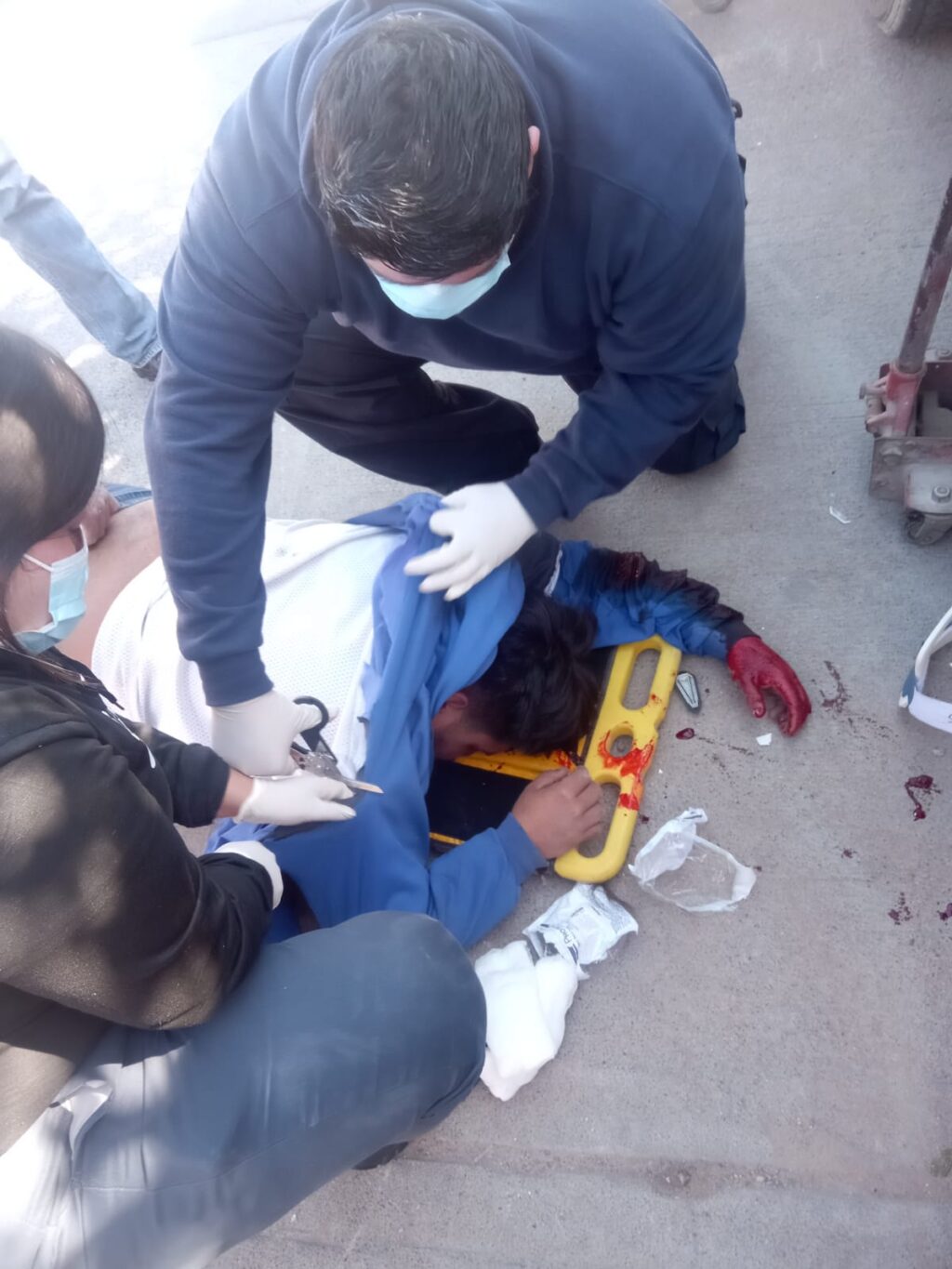 Adolescente motociclista murió tras estrellarse contra un automóvil en Pocitos