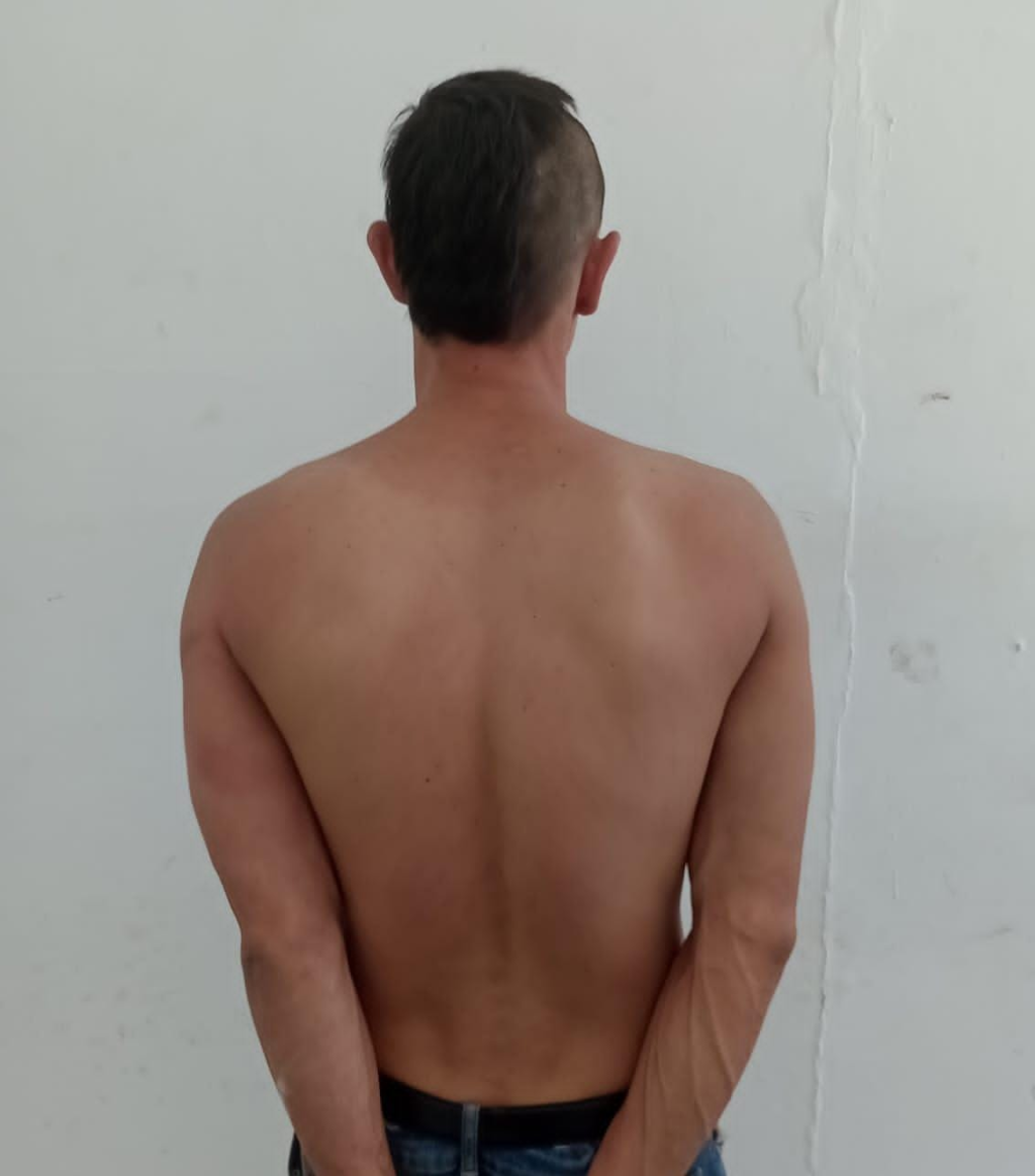 Detienen a sujeto acusado de agredir a una mujer en Las Américas