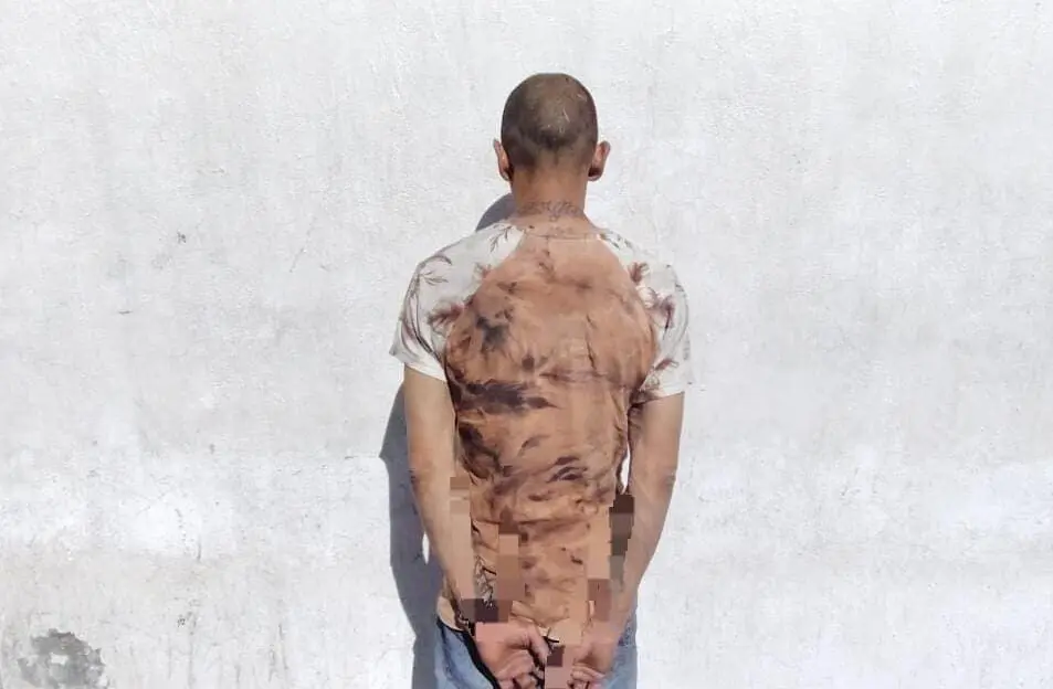 Detienen a dueño de perro que atacó a elemento de la Policía Municipal