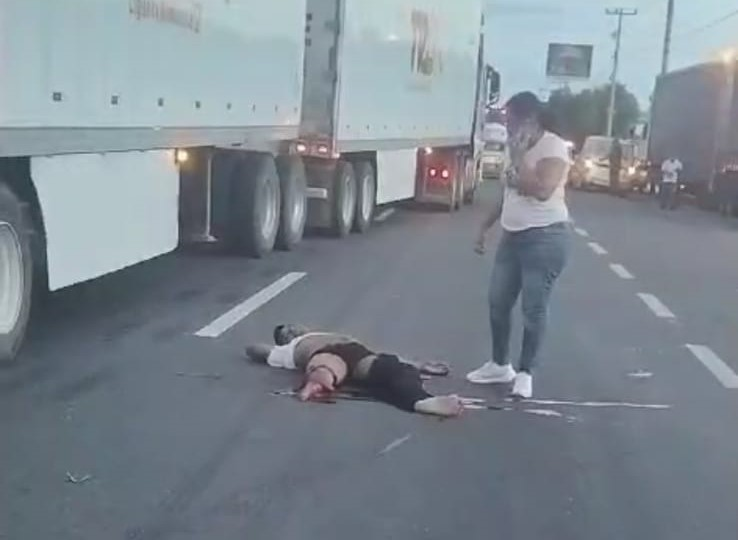 Muere hombre que sufrió amputación tras ser arrollado por un tráiler en la 45 Sur