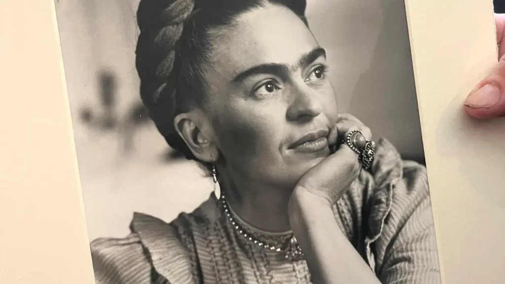 Diagnostican la afectación de Frida Kahlo 70 años después