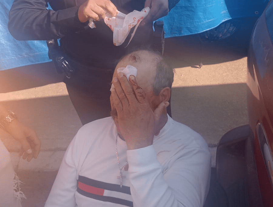 Hombre sufre herida en el rostro al utilizar una pulidora