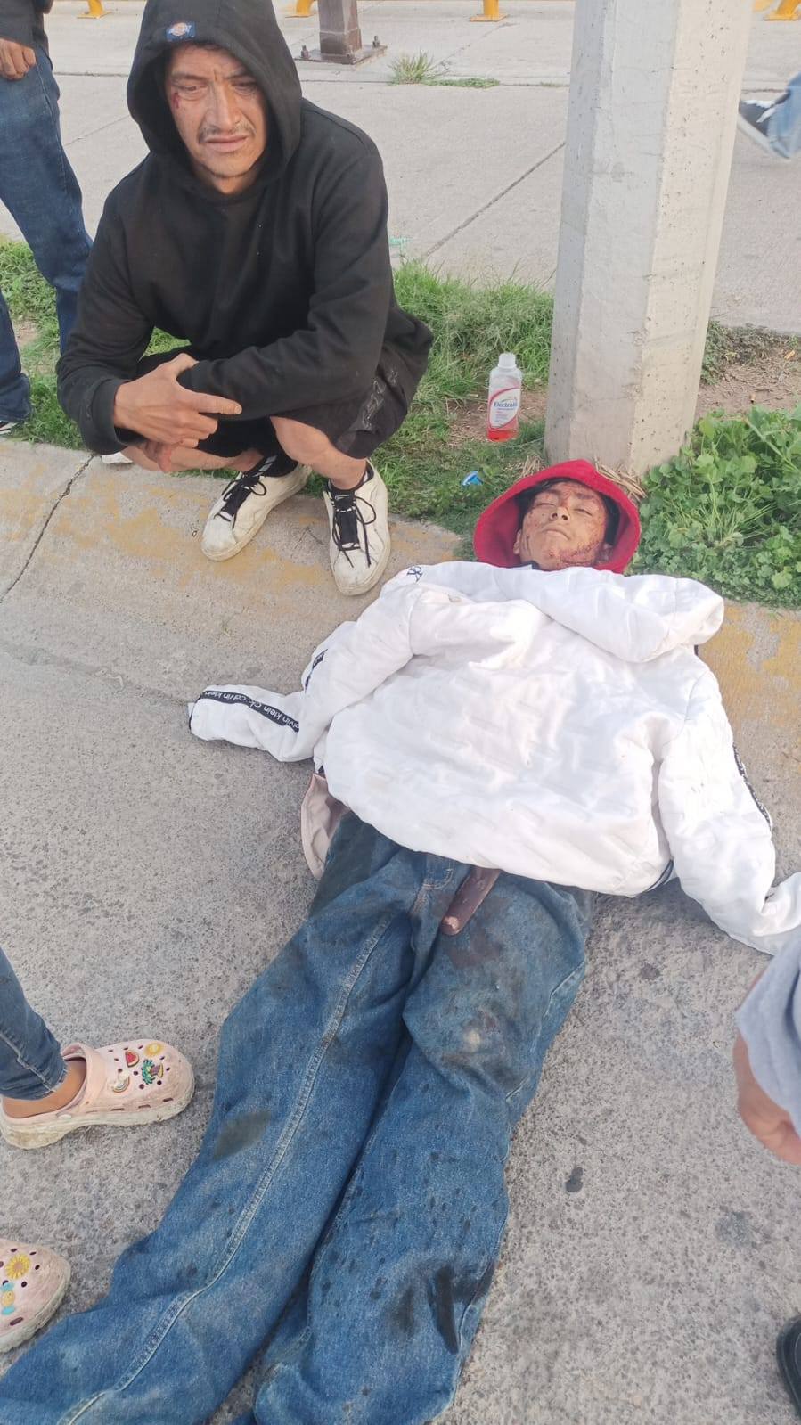 Riña a machetazos deja a un joven gravemente herido en el fraccionamiento Miradores
