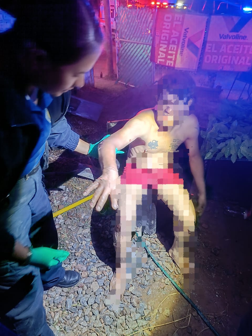 Joven sufre quemaduras en los brazos tras provocar un flamazo en su casa en El Puertecito