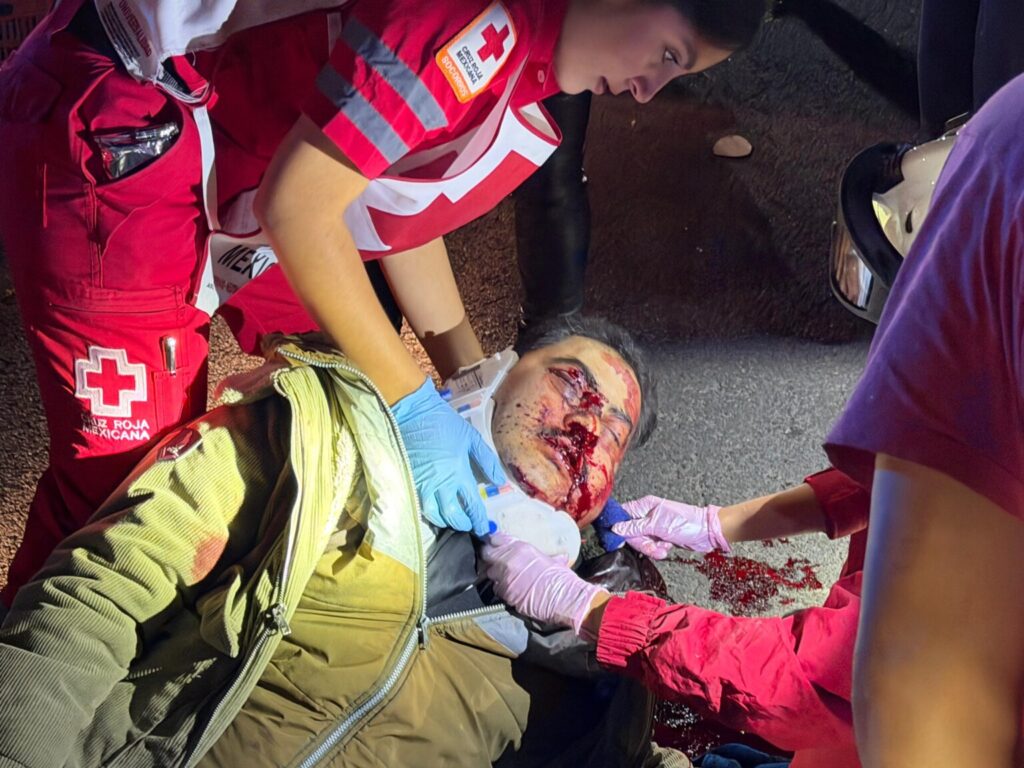 MOTORISTA EBRIO SUFRE CAIDA Y RESULTA GRAVE